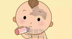 胎记怎么去除？胎记产生的原因是什么？ width=