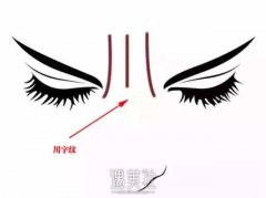 眉中川字纹怎么解决? width=
