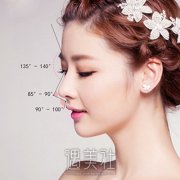 无疤隆鼻优势在哪里? width=