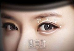 开眼角手术好吗?有没有坏处? width=