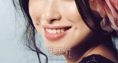 人造酒窝是怎么做的? width=