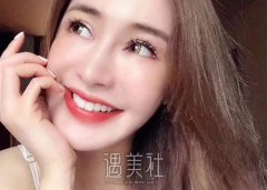 下颌角截骨术适合哪些人做 width=