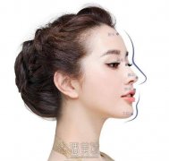 耳软骨隆鼻一个月较丑的时间怎么度过 width=