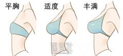 琴面假体隆胸好不好?术后怎么护理? width=