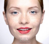 蝴蝶斑的形成原因是什么? width=