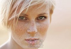 激光黄褐斑后反黑5个月还没好是怎么回事 width=
