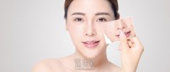 咖啡斑能吗 width=