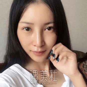 黄烨华做坏的案例有吗？成功案例也可以看看~ width=