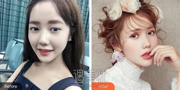 黄烨华整形医生好不好？有真实案例给看看吗？ width=