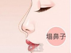 硅胶隆鼻手术副作用是什么？出现这些情况和什么有关？ width=