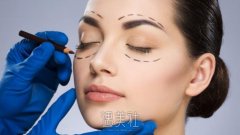 只做了激光去眼袋手术，从“阿姨脸”变成“少女脸”！ width=