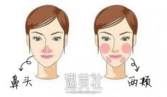 红血丝怎么消除?什么办法可以快速简单的消除红血丝呢? width=
