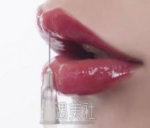 胶原蛋白丰唇没问题吗?丰唇果自然吗?真人图~ width=