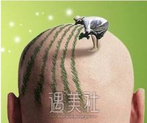 头发比较稀疏怎么办?如何解锁“茂密黑森林”? width=