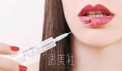 胶原蛋白丰唇果好吗?术后会出现副作用吗? width=