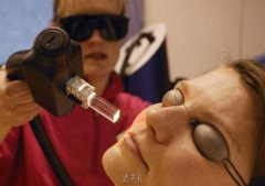 光子嫩肤后注意事项有哪些？要做几个疗程？ width=