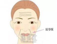 鼻唇沟和法令纹的区别到底是什么?小白必看 width=