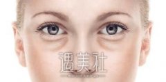 怎样去除眼袋皱纹-妙方小窍门 width=