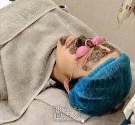 黑脸娃娃改良色素沉著果怎么样? width=