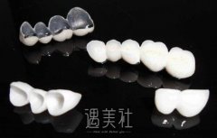 钯金烤瓷牙做之后感觉怎么样?可以去做核磁共振吗? width=