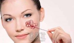 激光祛除红血丝果简直是太厉害了，脸上干净的像一张白纸 width=