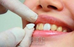 2021年牙科收费价目表(公立私立概况)，收费标准一览~ width=