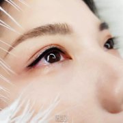 美瞳线失败案例图片分享，失败后怎么办？ width=