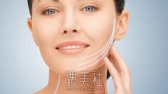 v美减龄是什么手术？能维持几年？ width=