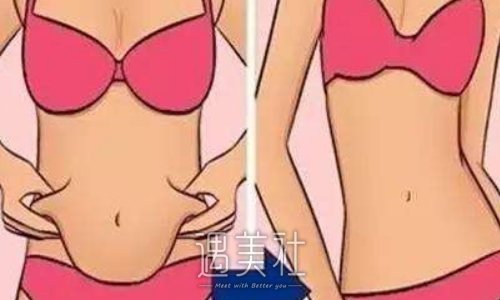 超脂塑吸脂后恢复较快秘诀公开｜一起看看注意事项有哪些吧 width=