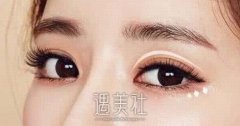 承德割双眼皮一般价位是多少？哪家医院好？附价目表 width=