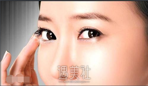 割双眼皮前后对比图欣赏，如果你觉得好看也可以去尝试哟！ width=