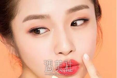 开眼角前后对比照片欣赏 width=