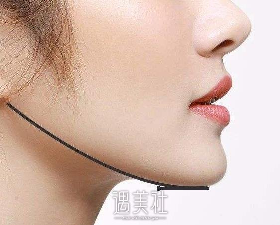 光纤去双下巴果怎样？怎样快速去除双下巴？ width=