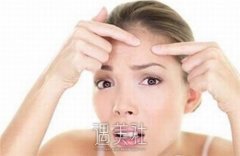 激光祛痘要花多少钱？影响因素有什么呢？ width=