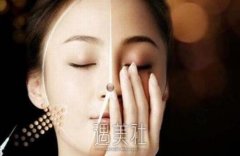 玻尿酸填充泪沟失败如何修复呢？ width=