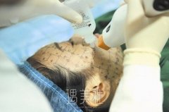 这个堪称热玛吉平替，做一次能年轻10岁？！ width=