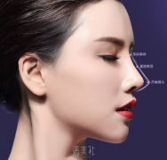 垫鼻头优缺点有哪些呢？快来看看吧 width=