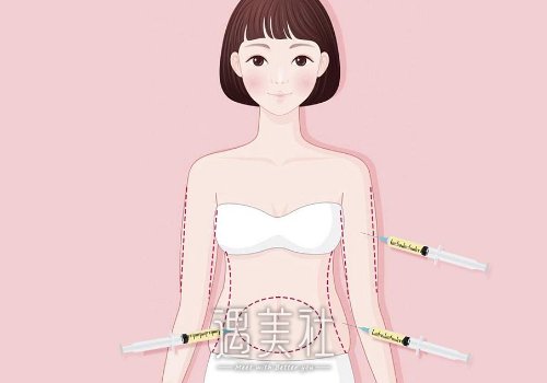 溶脂针一定要打三次吗？会有副作用吗？ width=