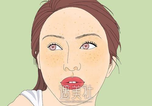 镭射净肤需要做几次？有副作用吗？ width=