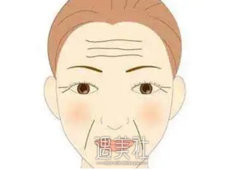抬头纹怎么去除？哪种方法效果好？ width=