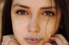 激光祛斑疼吗？您可以考虑以下建议 width=