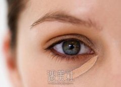 用什么方法取出黑眼圈好？下面是几种常见的医美方法分享 width=