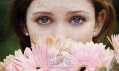 黄褐斑与晒斑有什么区别？你知道吗？ width=