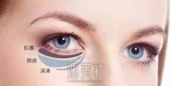 眼袋一旦形成能消除吗？调节方法有哪些？ width=