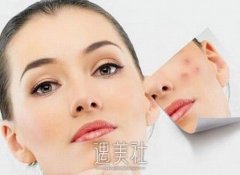 修复疤痕的方法有哪些呢？如何预防疤痕产生？ width=