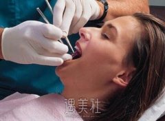 洗牙要多久时间？通常受哪些因素的影响？ width=