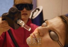激光嫩肤去除青春痘的效果怎么样呢？ width=