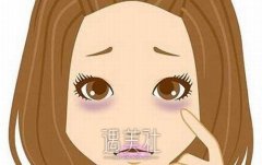 如何去眼纹？帮助你拥有年轻、健康的眼部皮肤 width=