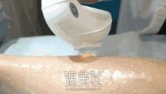 男士永久脱毛效果如何呢？怎么改良呢？ width=