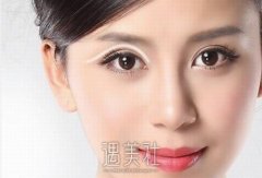 埋线双眼皮是永久的吗？有哪些优点呢？ width=
